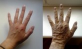 Dominika_Barton postarzanie dłoni, przed i po
