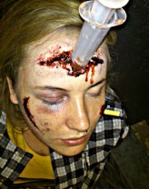 Aga_Kaspersky                             Rany kłute, cięte, poparzenia, sińce  i inne..            