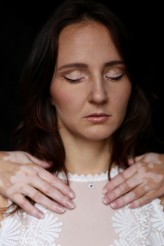 renata_plaszowska Projekt:
https://www.instagram.com/vitiligo_people/
Foto: Justyna Dudziak
