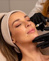 alicjablicharz dla Beauty Lab Clinic